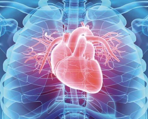 Heart Disease