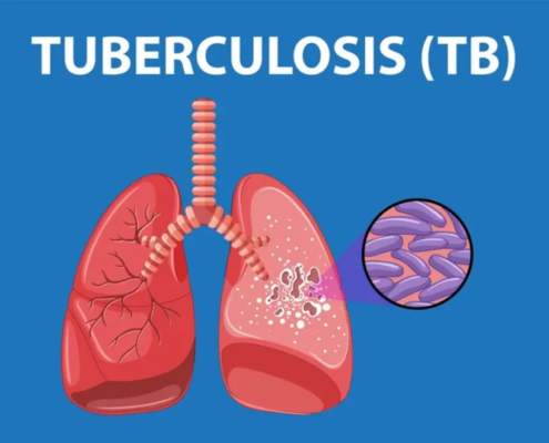 India's TB Crisis