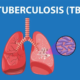 India's TB Crisis
