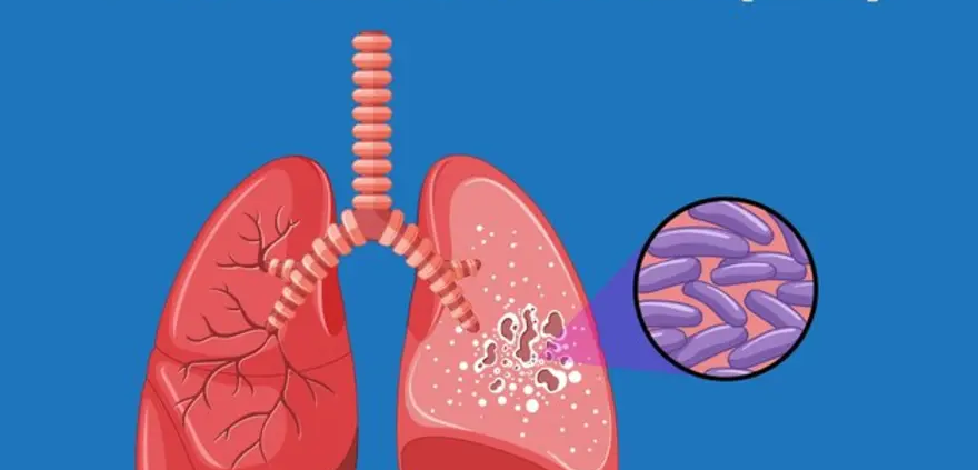 India's TB Crisis