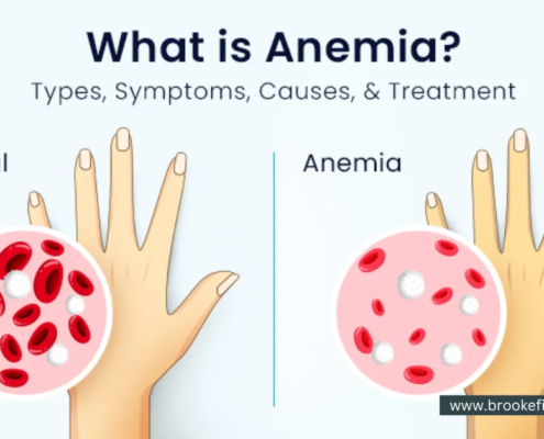Anemia