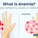 Anemia