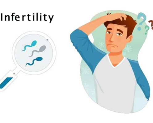 Male Infertility