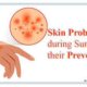 Summer Skin Problems