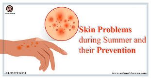 Summer Skin Problems